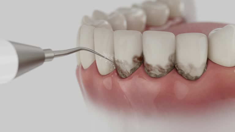 Reliable Dental Implants contractor in Copperopolis, CA by Smile Center Dentistry
